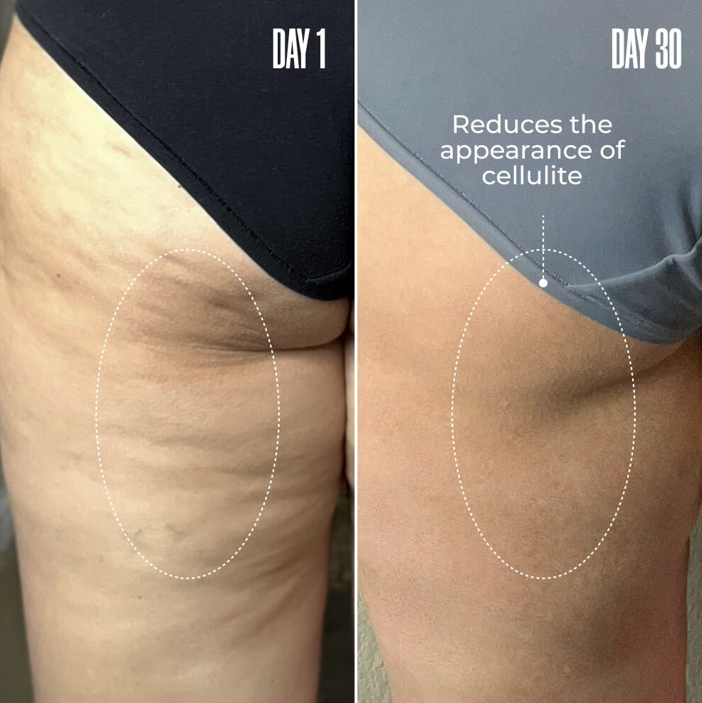 Saentity - B-TIGHT Maschera Rimodellante Effetto Lifting Glutei