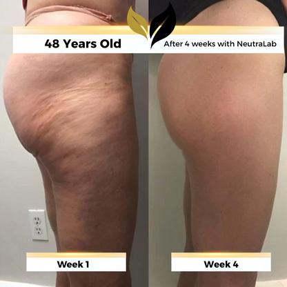 Saentity - Anti-Cellulite Massage Oil